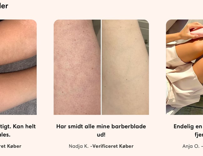 Innovativ Hårfjerner: Omsat for +0,5mDKK på kort tid